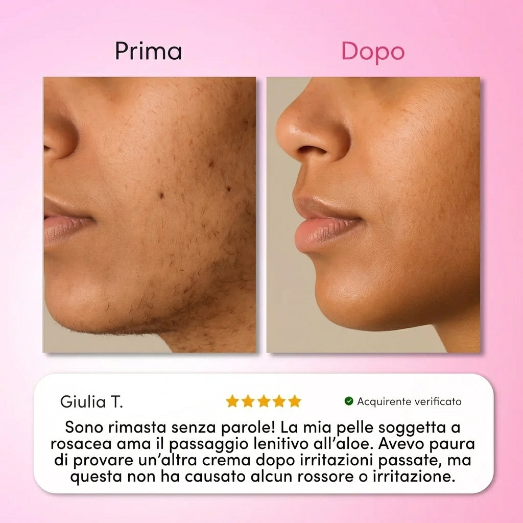 Solea® | Kit Trilogy per la Rimozione dei Peli