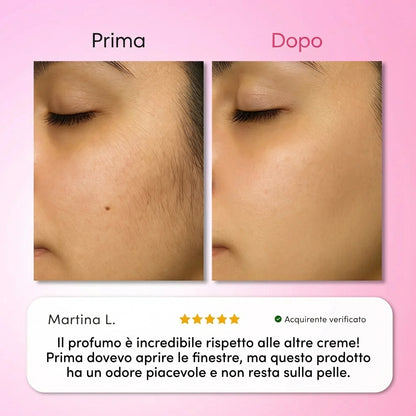 Solea® | Kit Trilogy per la Rimozione dei Peli