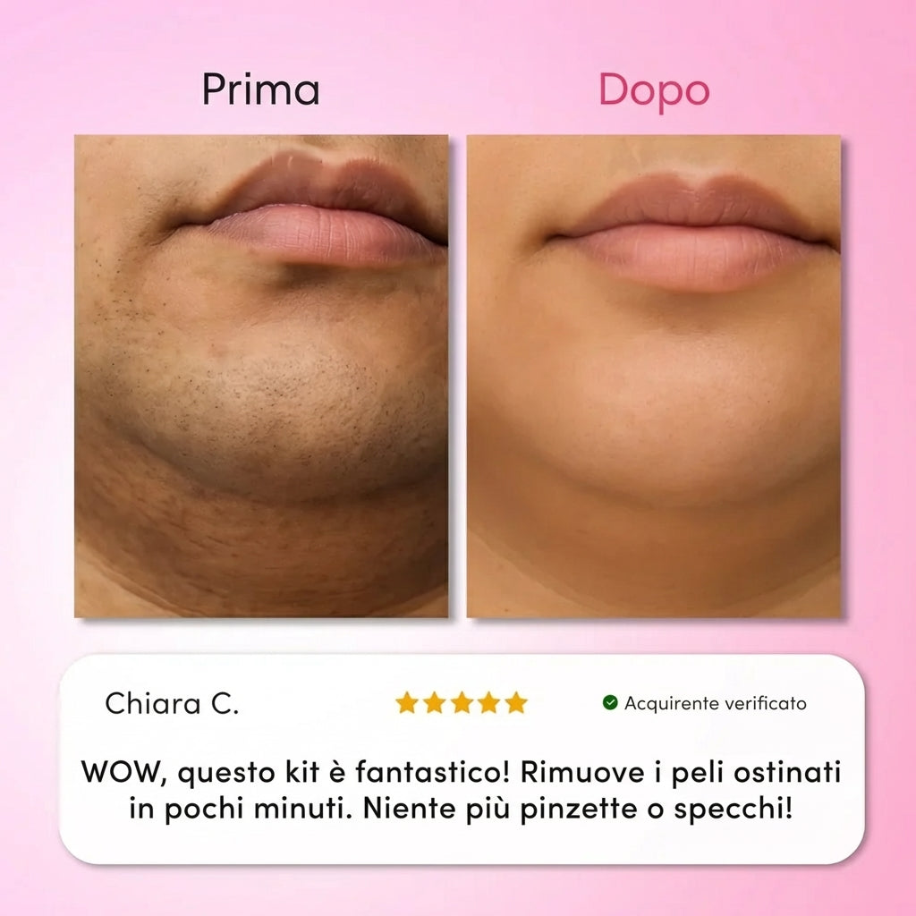 Solea® | Kit Trilogy per la Rimozione dei Peli