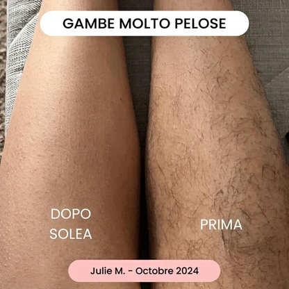 Solea® | Kit Trilogy per la Rimozione dei Peli
