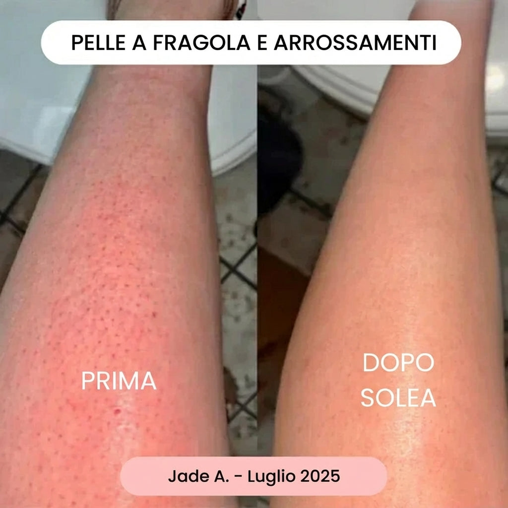 Solea® | Kit Trilogy per la Rimozione dei Peli